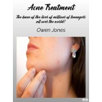 Acne Treatment-The Bane Of The Lives Of Millions Of Teenagers All Over The World!