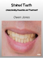 Stained Teeth-Understanding, Prevention, And Treatment!