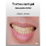 Trattare I Denti Gialli-Comprendere, Prevenire E Trattare!